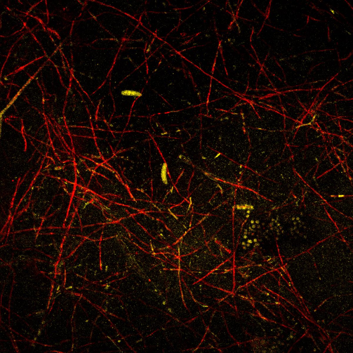 Community coalescence avec un tilleul, vue au Microscope confocal de Gif sur Yvette