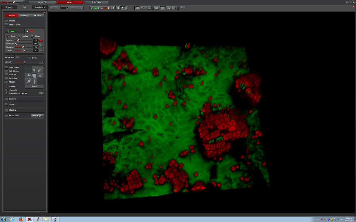 Community coalescence avec un hêtre, vue au Microscope confocal de Gif sur Yvette